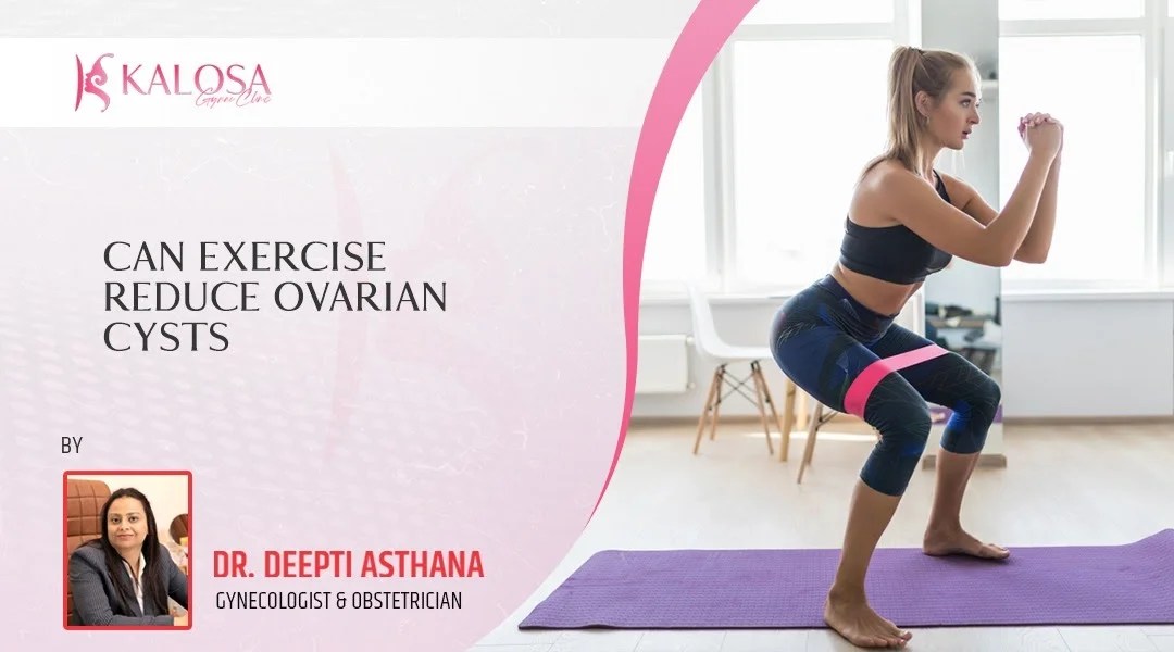 Can exercise reduce ovarian cysts?